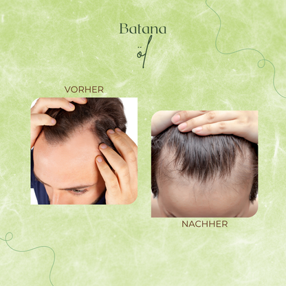 Batana oil – your natural miracle cure for hair loss 🌿✨ 